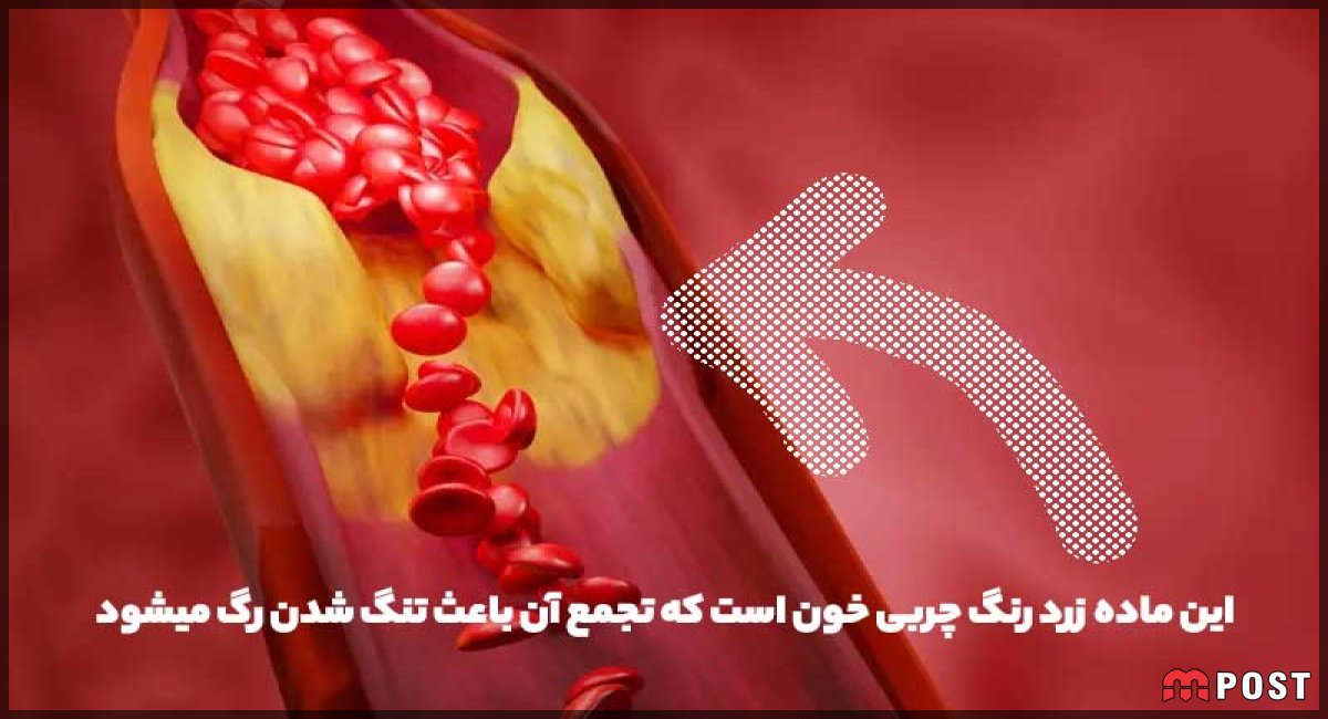 داروی چربی خون آتورواستاتین، نکات مهم مصرف و تداخلات دارویی
